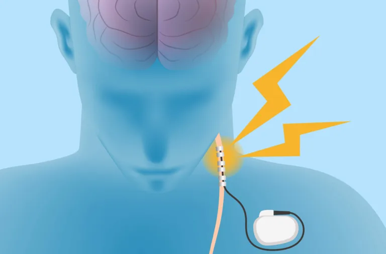 ChemistryCan_Neurostimulator device